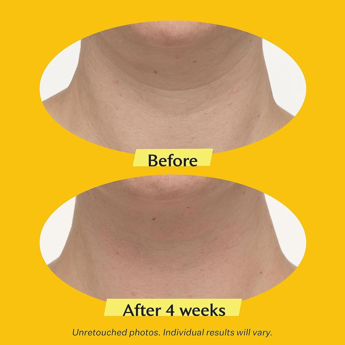 Gezichtscrème StriVectin Tl Advanced Tightening 50 ml