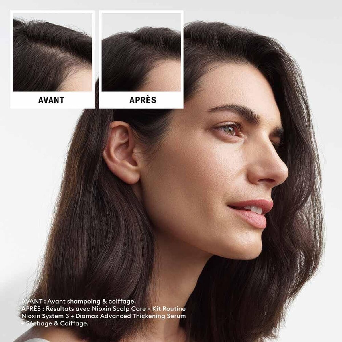 Shampoo en Conditioner Nioxin