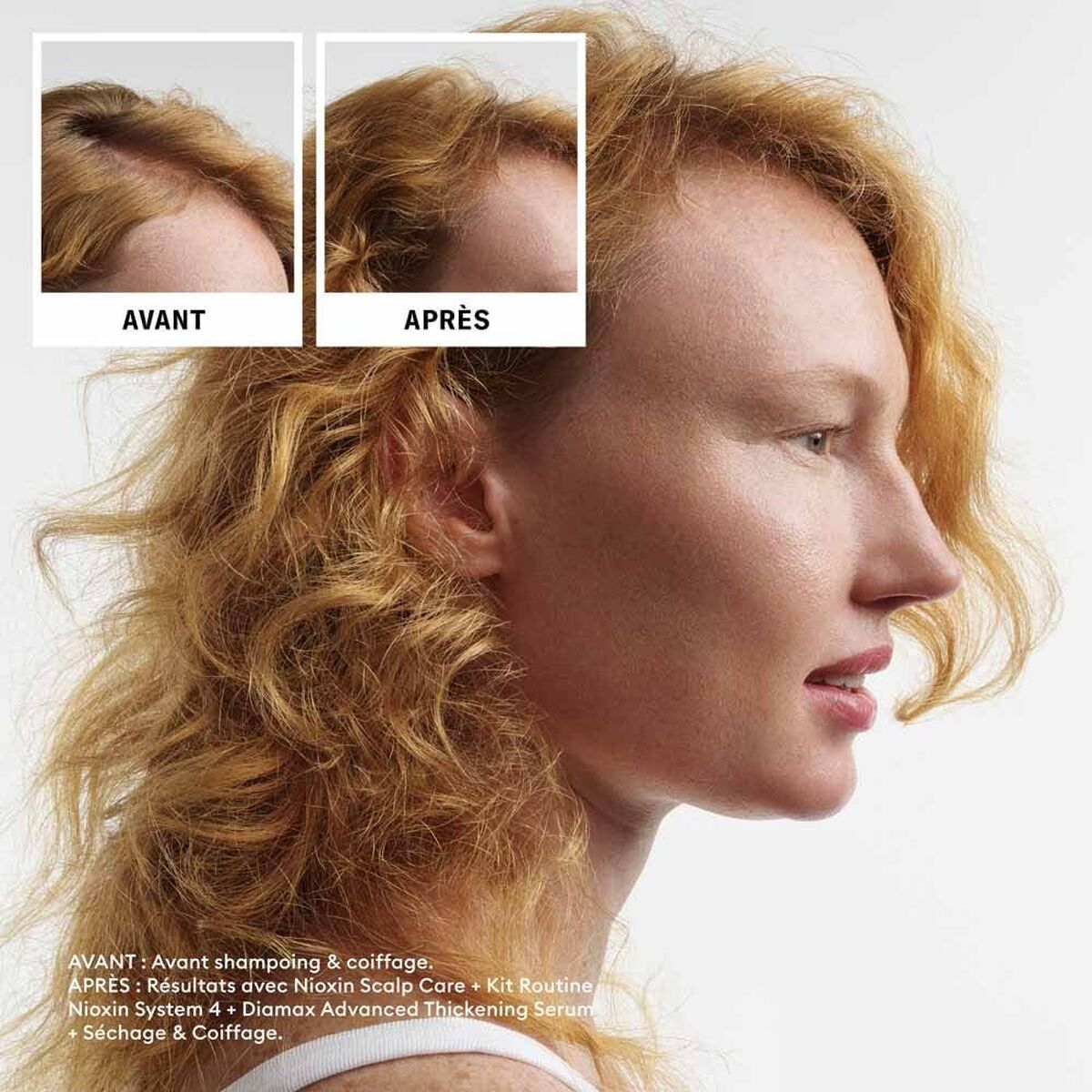 Shampoo en Conditioner Nioxin